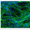 科学家确定致病途径和潜在治疗方法